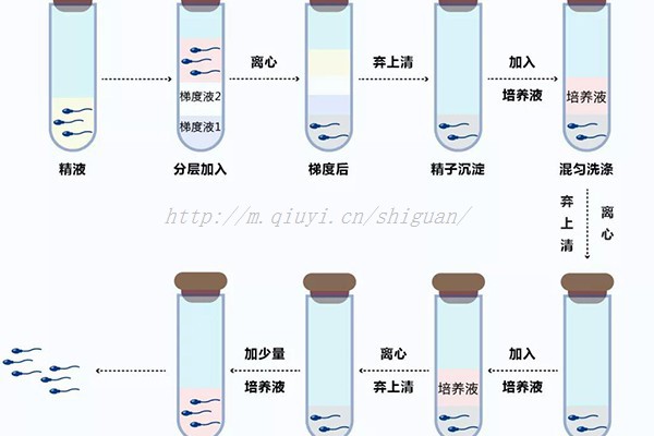 东莞借卵试管生子生一对龙凤胎价格明细，做供卵试管费用得这个数