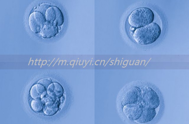 人工授精辅助操作有哪些，人工辅助授精成功几率大吗