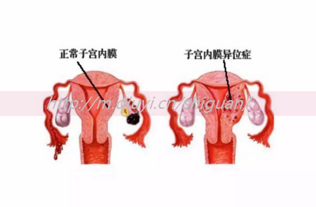 人工授精的男性细胞需要冻住吗_人工授精需要洗精吗