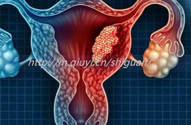 多囊怀孕多久能促排卵成功？多囊促排卵怀孕后的宝宝健康吗？