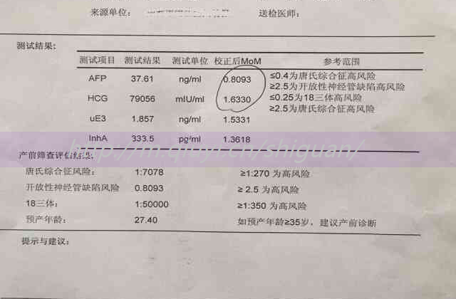 人工授精一次会几个宝宝？人工授精一次会几个宝宝畸形？