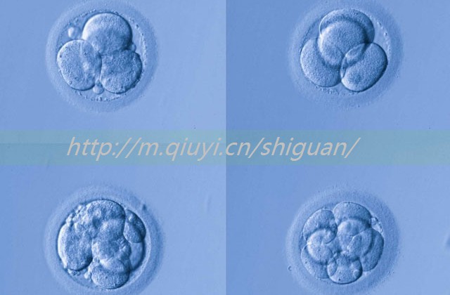 人工授精属于高危孕妇吗，人工授精算是正常怀孕吗