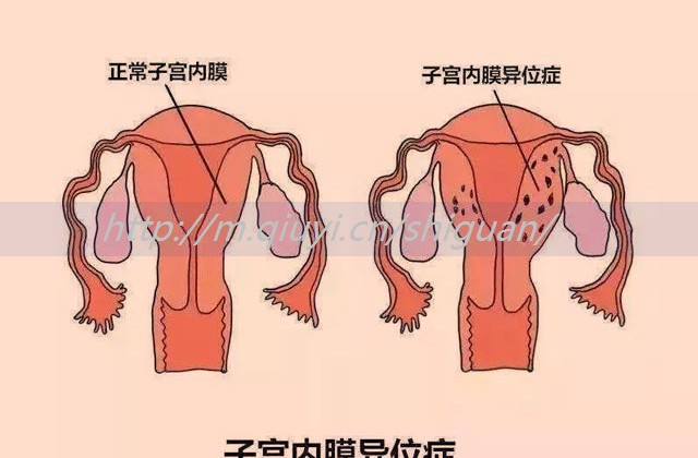 打了促排卵针可以吃东西吗？打促排卵针可以吃早饭吗？