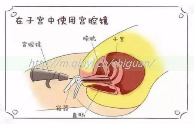 人工授精助孕生子可以多胎吗，人工授精宝宝宝的多吗